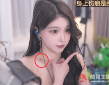 锁骨上有明显“草莓印”，是哪个有钱人弄的，苏恩回应是刮痧所致